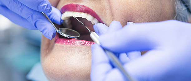 Best Knocked-Out Tooth (Avulsed Tooth) Treatment in Freemansburg, PA